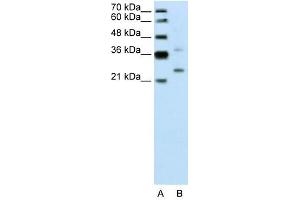 DCUN1D1 antibody used at 0. (DCUN1D1 Antikörper)