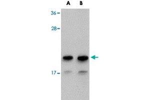Western blot analysis of NDUFAF2 in Raji cell lysate with NDUFAF2 polyclonal antibody  at (A) 1 and (B) 2 ug/mL . (NDUFAF2 Antikörper  (C-Term))