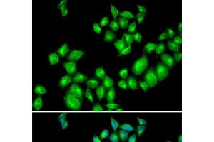 Immunofluorescence analysis of U2OS cells using DRD3 Polyclonal Antibody (DRD3 Antikörper)