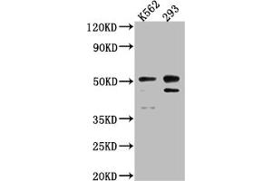 Western Blot Positive WB detected in: K562 whole cell lysate, 293 whole cell lysate All lanes: Caspase-2 antibody at 1:1000 Secondary Goat polyclonal to rabbit IgG at 1/50000 dilution Predicted band size: 51, 35, 11 kDa Observed band size: 51 kDa (Rekombinanter Caspase 2 Antikörper)