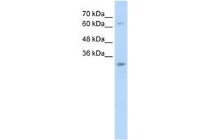 Western Blotting (WB) image for anti-Non-SMC Element 1 Homolog (NSMCE1) antibody (ABIN2462690) (NSMCE1 Antikörper)