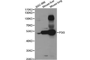 Western blot analysis of extracts of various cell lines, using FGG antibody. (FGG Antikörper)
