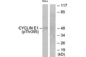 Western blot analysis of extracts from HeLa cells treated with Paclitaxel 1uM 60', using Cyclin E1 (Phospho-Thr395) Antibody. (Cyclin E1 Antikörper  (pThr395))