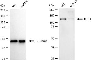 Western blotting analysis using IFIH1 antibody (ABIN7799084).