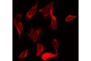 ABIN6269408 staining NIH-3T3 by IF/ICC. (CaMK2 alpha/delta Antikörper)