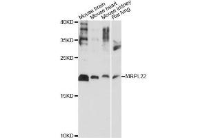 Western blot analysis of extracts of various cell lines, using MRPL22 antibody (ABIN6292563) at 1:1000 dilution. (MRPL22 Antikörper)