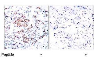 Image no. 1 for anti-Signal Transducer and Activator of Transcription 5A (STAT5A) (Tyr694) antibody (ABIN197180) (STAT5A Antikörper  (Tyr694))