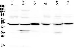 Western blot analysis of GDA using anti-GDA antibody . (GDA Antikörper  (AA 220-446))