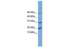 PRR13 antibody used at 1 ug/ml to detect target protein. (Proline Rich 13 Antikörper  (N-Term))