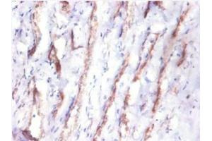 Immunohistochemistry of paraffin-embedded human kidney tissue using ABIN7148991 at dilution of 1:10 (CST3 Antikörper  (AA 27-146))