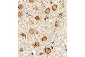 Immunohistochemical analysis of paraffin-embedded M. (Myosin Antikörper  (AA 654-668))