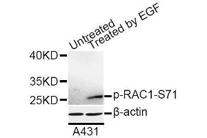 Western blot analysis of extracts of A-431 cells, using Phospho-RAC1-S71 antibody (ABIN5969930) at 1/1000 dilution. (RAC1 Antikörper  (pSer71))