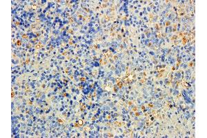 ABIN184635 (5ug/ml) staining of paraffin embedded Rat Spleen. (MTMR9 Antikörper  (C-Term))
