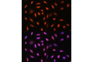 Immunofluorescence analysis of U2OS cells using DDIT3/CHOP Rabbit pAb (ABIN6131563, ABIN6139461, ABIN6139464 and ABIN6222163) at dilution of 1:100. (DDIT3 Antikörper)