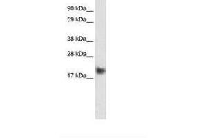 Image no. 1 for anti-Cysteine and Glycine-Rich Protein 3 (CSRP3) (C-Term) antibody (ABIN6735943) (CSRP3 Antikörper  (C-Term))