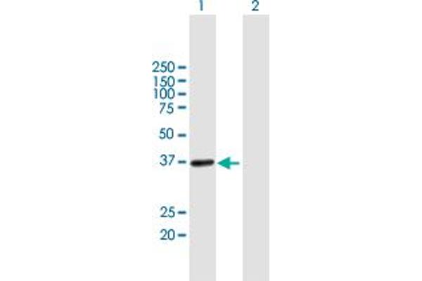 UPRT antibody  (AA 1-309)