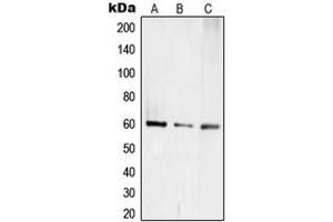 Western blot analysis of TCEB3C expression in Jurkat (A), mouse kidney (B), rat kidney (C) whole cell lysates. (TCEB3C Antikörper  (C-Term))