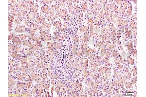 Formalin-fixed and paraffin embedded rat liver tissue labeled Anti-GHR Polyclonal Antibody, Unconjugated (ABIN671481) at 1:400, followed by conjugation to the secondary antibody and DAB staining (Growth Hormone Receptor Antikörper  (AA 101-200))