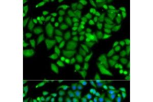 Immunofluorescence analysis of MCF-7 cells using CHAF1B Polyclonal Antibody (CHAF1B Antikörper)