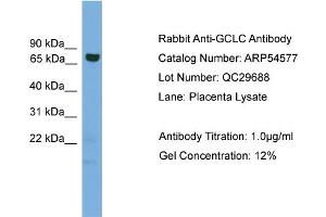 WB Suggested Anti-GCLC  Antibody Titration: 0. (GCLC Antikörper  (Middle Region))