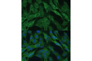 Immunofluorescence analysis of C6 cells using IDH1 Polyclonal Antibody (ABIN6131797, ABIN6142143, ABIN6142144 and ABIN6217174) at dilution of 1:100 (40x lens). (IDH1 Antikörper  (AA 1-414))