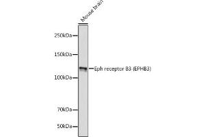 Western blot analysis of extracts of Mouse brain, using Eph receptor B3 (EPHB3) (EPHB3) antibody (ABIN7266972) at 1:1000 dilution. (EPH Receptor B3 Antikörper)