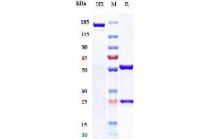 Anti-CD38 Reference Antibody (isatuximab) on SDS-PAGE under reducing (R) condition. (Rekombinanter CD38 (Isatuximab Biosimilar) Antikörper)