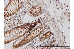 Immunoperoxidase of monoclonal antibody to HIP1 on formalin-fixed paraffin-embedded human colon. (HIP1 Antikörper  (AA 928-1037))