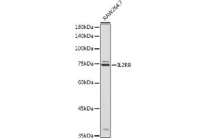 Western blot analysis of extracts of R. (IL2 Receptor beta Antikörper  (AA 27-240))