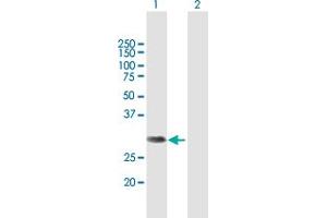 Western Blot analysis of NSMCE2 expression in transfected 293T cell line by NSMCE2 MaxPab polyclonal antibody. (NSMCE2 Antikörper  (AA 1-247))