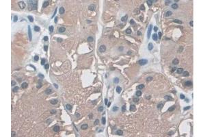 Immunohistochemistry (IHC) image for anti-Myosin Heavy Chain 7, Cardiac Muscle, beta (MYH7) (AA 26-309) antibody (ABIN7440755)