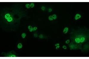 Anti-TP53 mouse monoclonal antibody (ABIN2454550) immunofluorescent staining of COS7 cells transiently transfected by pCMV6-ENTRY TP53 (RC200003). (p53 Antikörper)