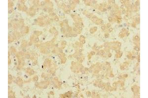 Immunohistochemistry of paraffin-embedded human liver tissue using ABIN7165454 at dilution of 1:100 (FAM187B Antikörper  (AA 18-335))