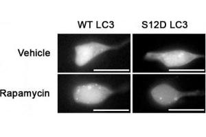 SH-SY5Y cells expressing GFP-LC3-WT or-S12D mutation (reduced puncta) treated with rapamycin or vehicle for 1h and probed with phospho-LC3C antibody (LC3C Antikörper  (pSer12))