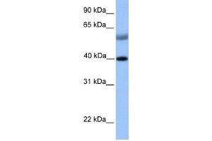 WB Suggested Anti-ISL1 Antibody Titration:  0. (ISL1 Antikörper  (N-Term))