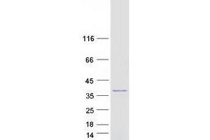 Western Blotting (WB) image for Thiosulfate Sulfurtransferase (Rhodanese) (TST) protein (Myc-DYKDDDDK Tag) (ABIN2733584)