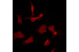 ABIN6267009 staining K562 by IF/ICC. (AKT1/3 Antikörper)