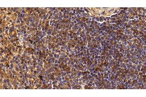 Detection of CD4 in Human Spleen Tissue using Polyclonal Antibody to Cluster Of Differentiation 4 (CD4) (CD4 Antikörper  (AA 27-394))