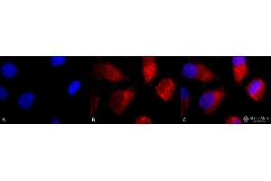 Immunocytochemistry/Immunofluorescence analysis using Rabbit Anti-TNF-R1 Polyclonal Antibody . (TNFRSF1A Antikörper  (AA 20-43) (Atto 488))