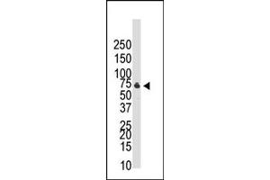 Image no. 1 for anti-Bone Morphogenetic Protein Receptor, Type IB (BMPR1B) (C-Term) antibody (ABIN357379) (BMPR1B Antikörper  (C-Term))