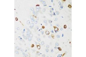 Immunohistochemistry (IHC) image for anti-ELAV (Embryonic Lethal, Abnormal Vision, Drosophila)-Like 2 (Hu Antigen B) (ELAVL2) (AA 1-100) antibody (ABIN6140114)