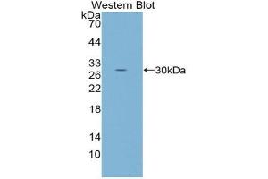Western blot analysis of the recombinant protein. (FOS Antikörper  (AA 55-298))
