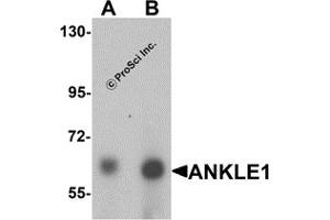 Western Blotting (WB) image for anti-Ankyrin Repeat and LEM Domain Containing 1 (ANKLE1) (C-Term) antibody (ABIN1030236) (ANKLE1 Antikörper  (C-Term))