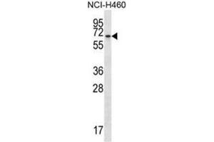 BEND4 Antibody (N-term) western blot analysis in NCI-H460 cell line lysates (35µg/lane). (BEND4 Antikörper  (N-Term))