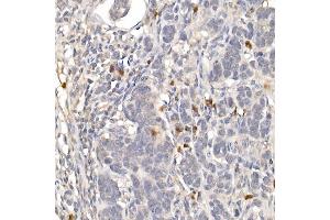 Immunohistochemistry (IHC) image for anti-Nuclear Receptor Subfamily 4, Group A, Member 1 (NR4A1) (AA 1-170) antibody (ABIN6144826)