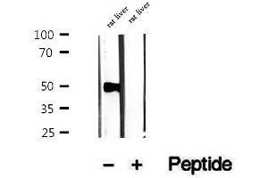Western blot analysis of extracts of rat liver tissue, using PMPCB antibody. (PMPCB Antikörper  (Internal Region))