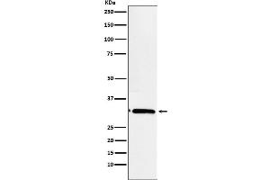 Western blot analysis of EB3 expression in Ratmuscle cell lysate.