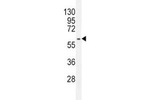 Western Blotting (WB) image for anti-Mdm2, p53 E3 Ubiquitin Protein Ligase Homolog (Mouse) (MDM2) (AA 393-424) antibody (ABIN3031739)