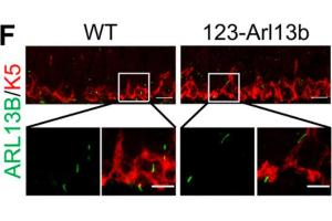 Representative confocal images of WT and Dp10 mouse embryonic fibroblasts. (ARL13B Antikörper  (C-Term))