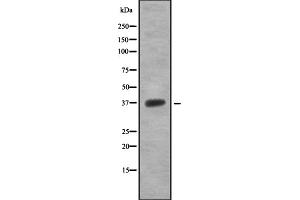 Western blot analysis OR5T1 using 293 whole cell lysates (OR5T1 Antikörper)